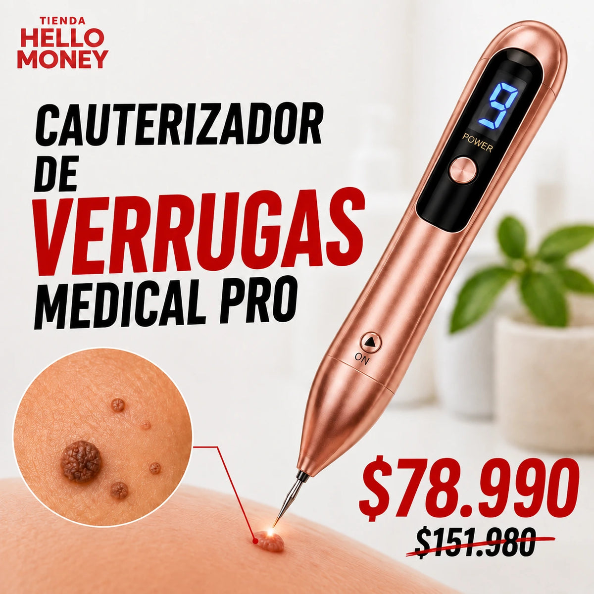 CAUTERIZADOR DE VERRUGAS MEDICAL PRO